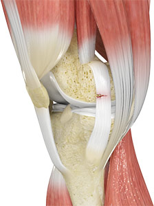 Ligament Injuries